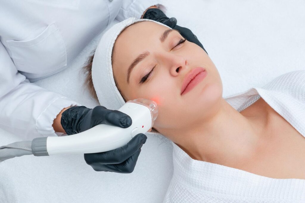 SkinPen Microneedling