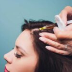 Hair Loss