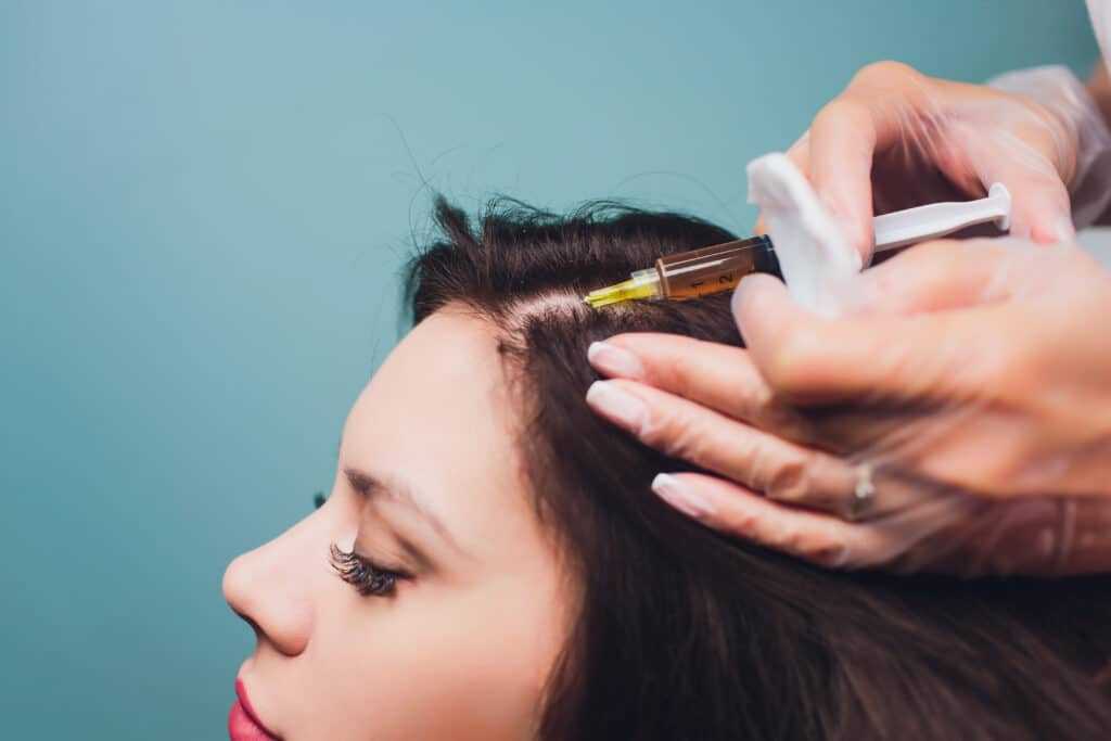 Hair Loss